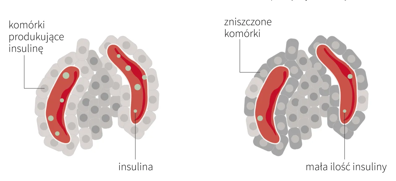 Mechanizm działania flozyn grafika