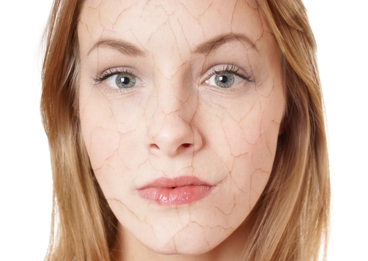 sk&oacute;ra sucha odwodniona przed po