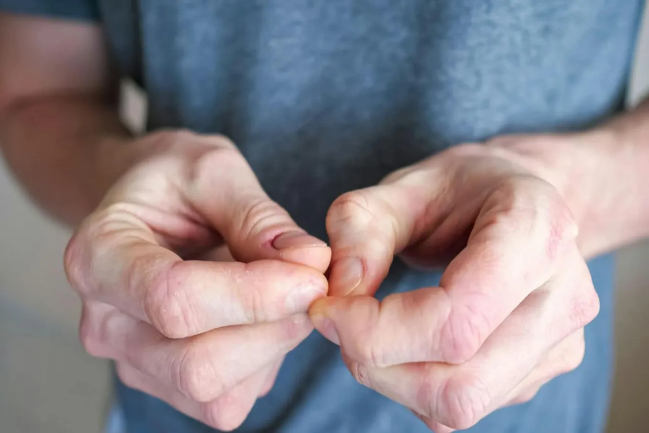 różne metody leczenia nerwicy grafika porównanie