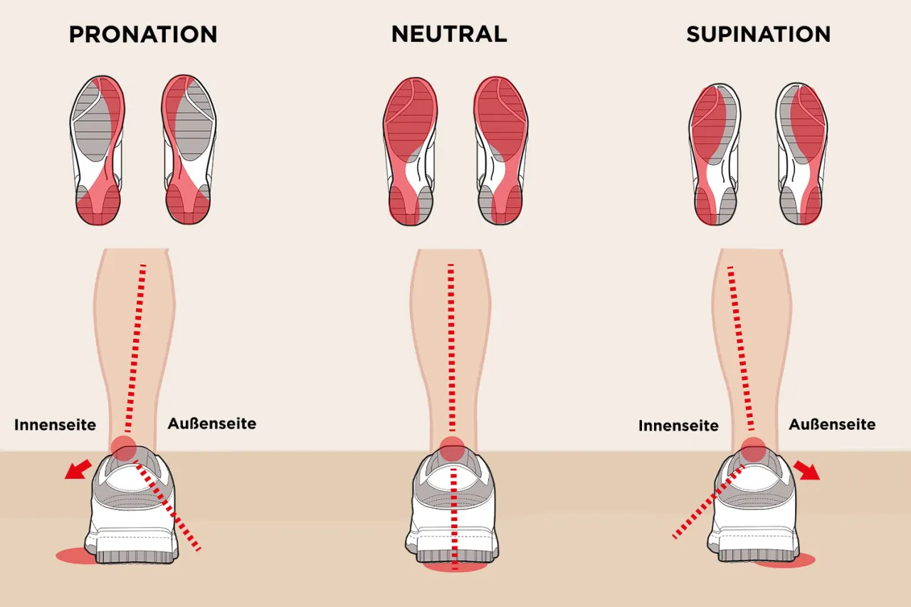 Laufanalyse Fuß Supination