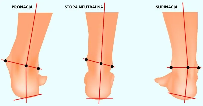 rodzaje st&oacute;p pronacja supinacja neutralna diagram