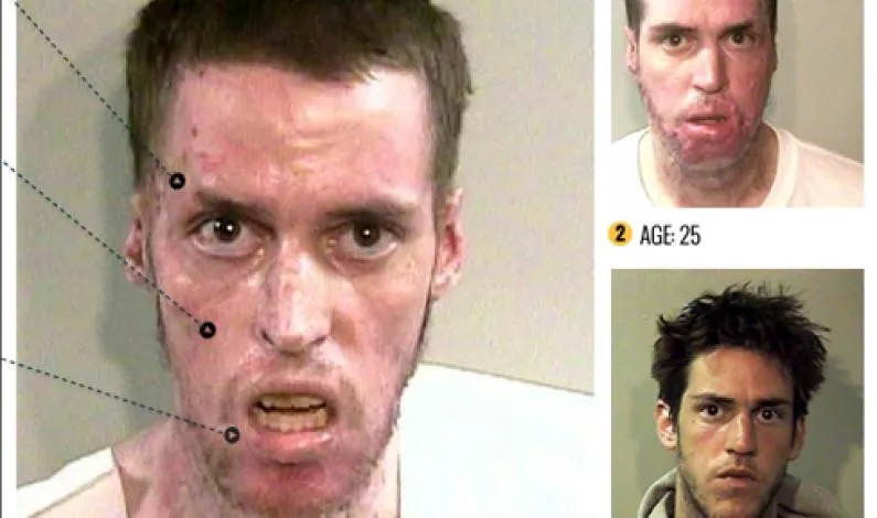 skutki zażywania mefedronu