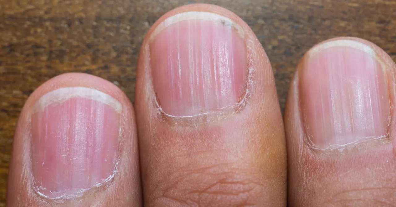 Objawy neurologiczne niedoboru żelaza