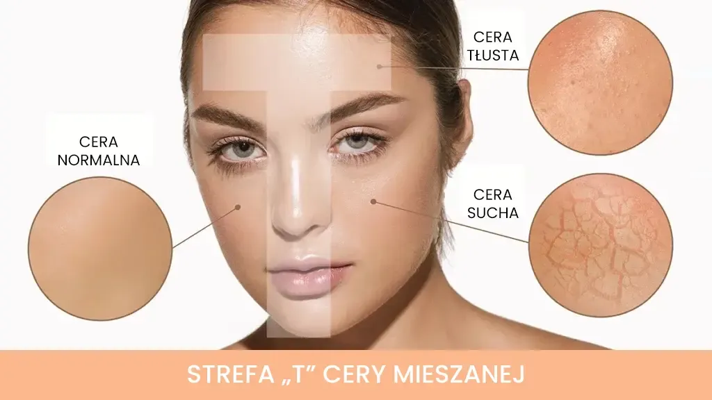 Zdjęcie Cera mieszana jaka to? Jak skutecznie zadbać o problematyczną skórę