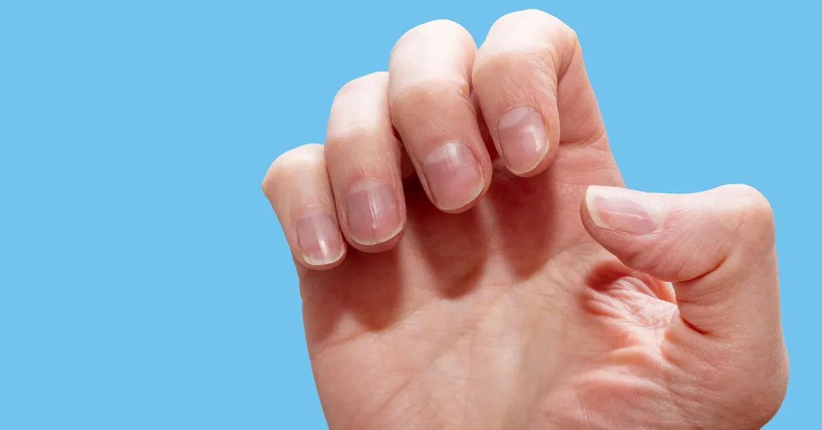 Zdjęcie Paski na paznokciach co oznaczają i co mogą mówić o twoim zdrowiu