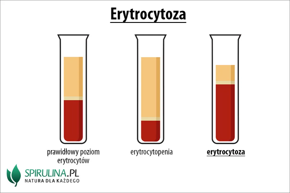 Zdjęcie Podwyższony poziom erytrocytów u dziecka – objawy, przyczyny i diagnostyka