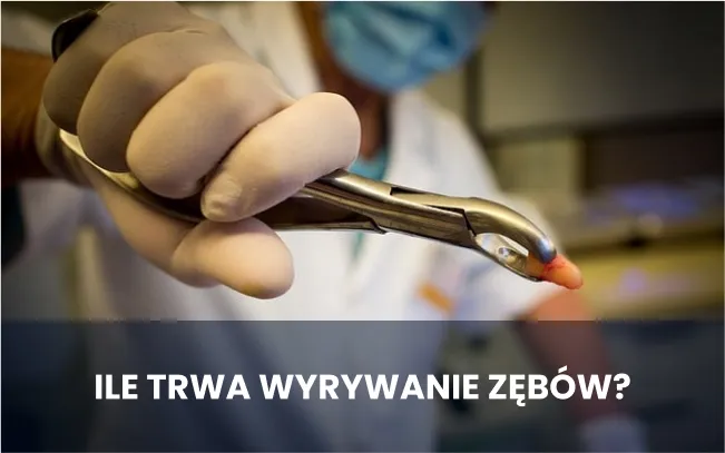 Zdjęcie Ekstrakcja siódemki: Ile trwa zabieg i co musisz wiedzieć?