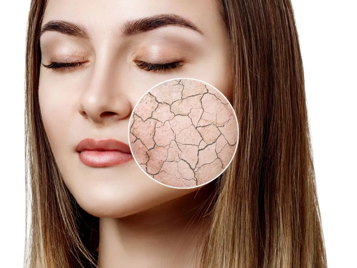 Pflegeroutine trockene schuppige Gesichtshaut