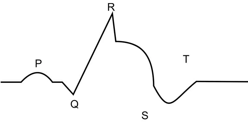 Wykres przedstawiający czynniki wpływające na czas rekonwalescencji po zawale serca