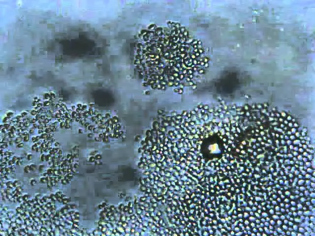 drożdże pod mikroskopem