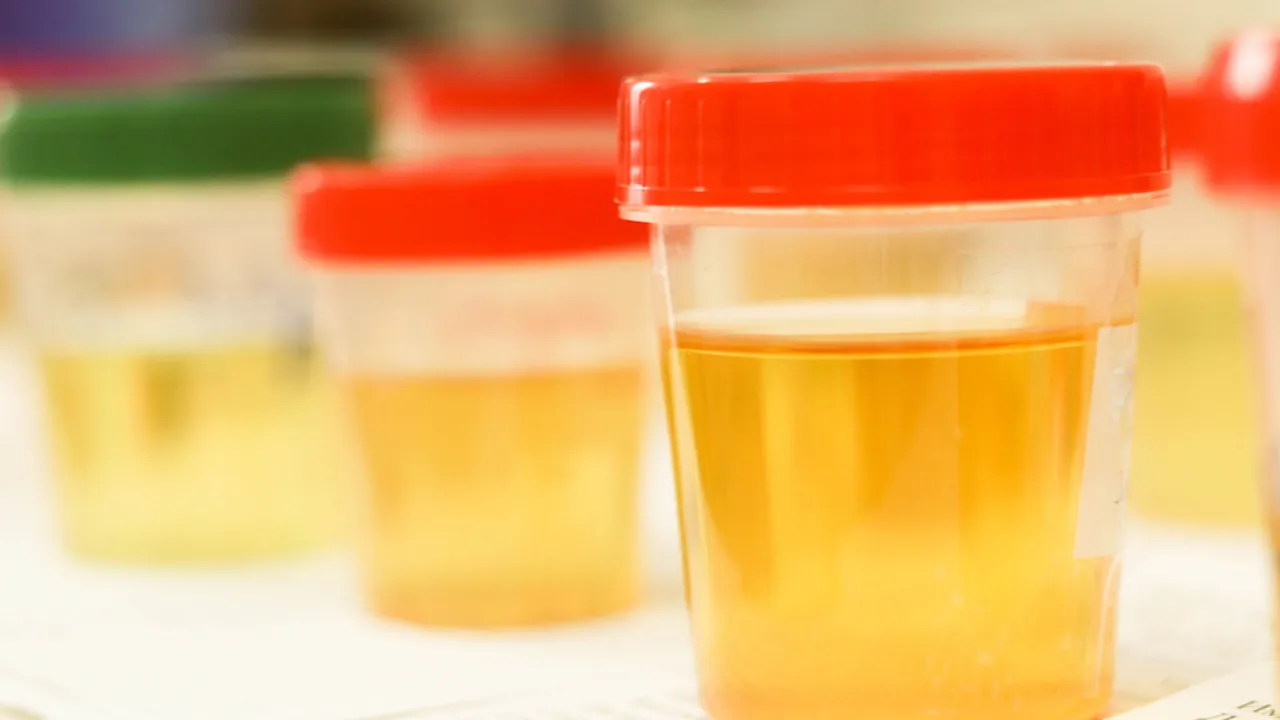 Pojemnik na mocz objętość