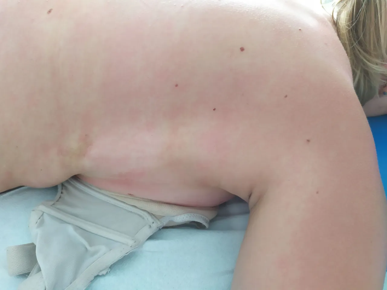 kobieta w źle dobranym biustonoszu sportowym b&oacute;l dyskomfort