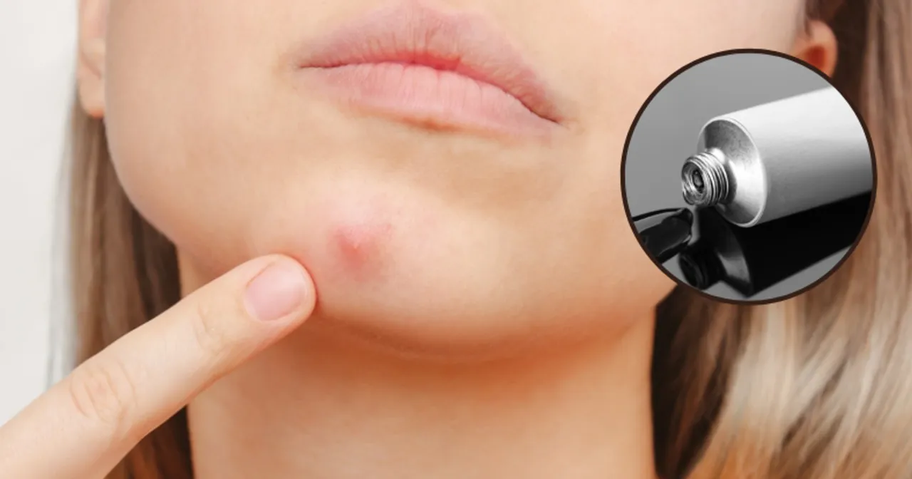 Maść ichtiolowa na pryszcze