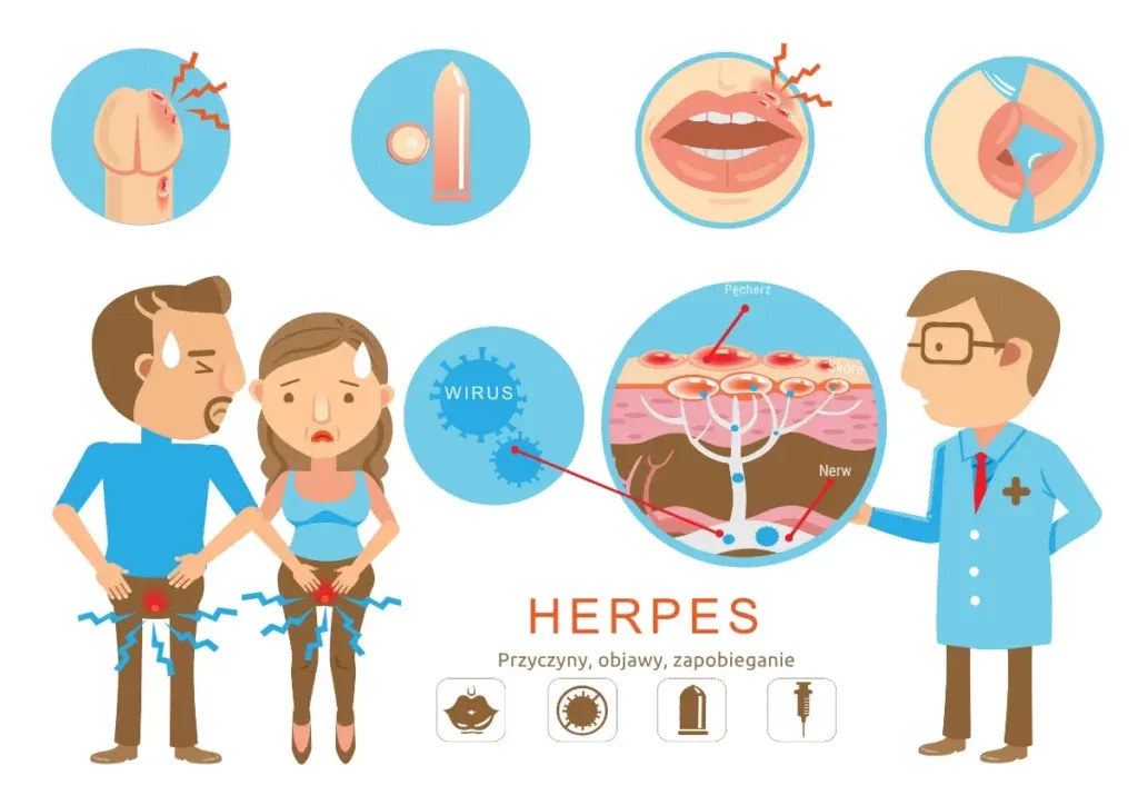 czynniki wywołujące opryszczkę grafika