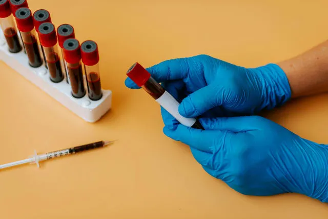 Bluttest Lebererkrankung