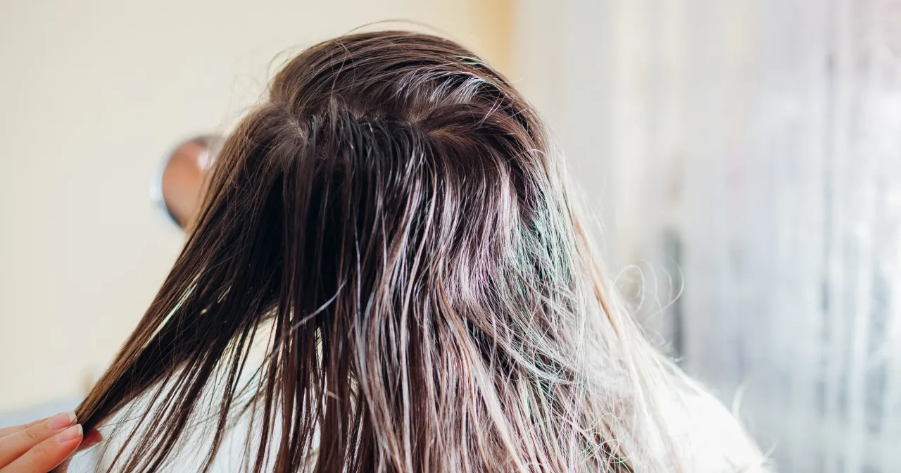 Przyczyny przetłuszczania się włos&oacute;w