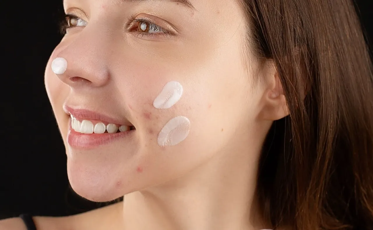 rodzaje zmian trądzikowych na brodzie