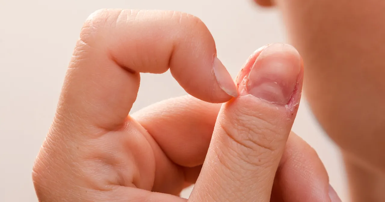 błędy przy domowym przyklejaniu paznokci infekcja