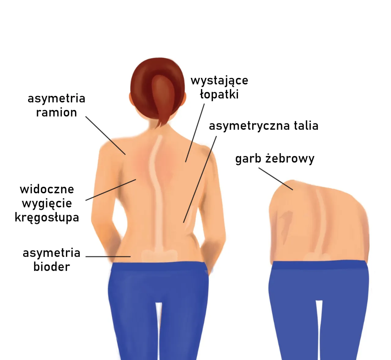 Zdjęcie Ile trwa rehabilitacja skoliozy? Poznaj kluczowe informacje i czas terapii
