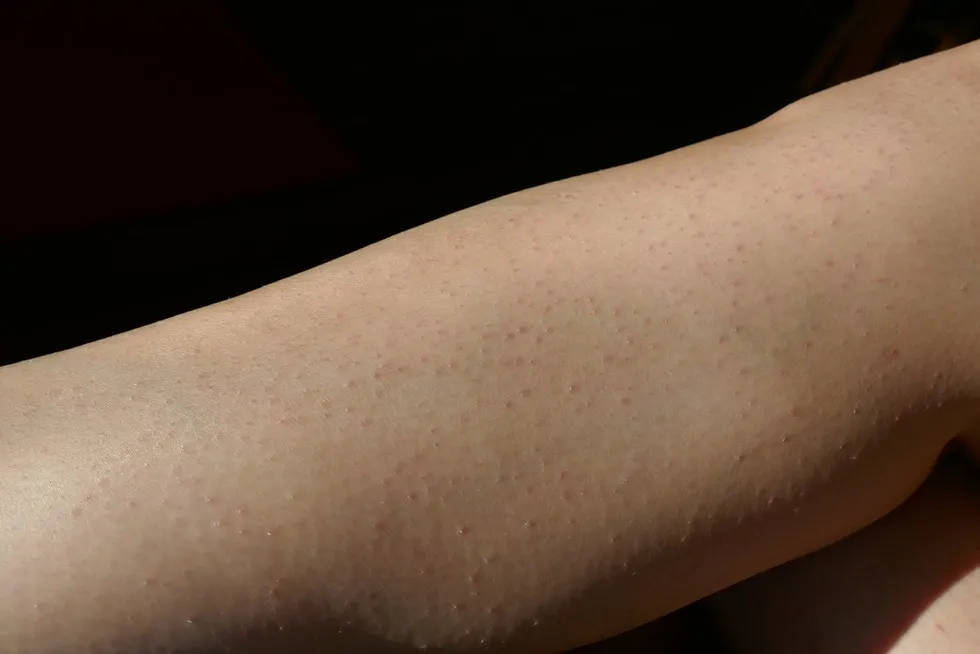 Błędy podczas depilacji depilatorem