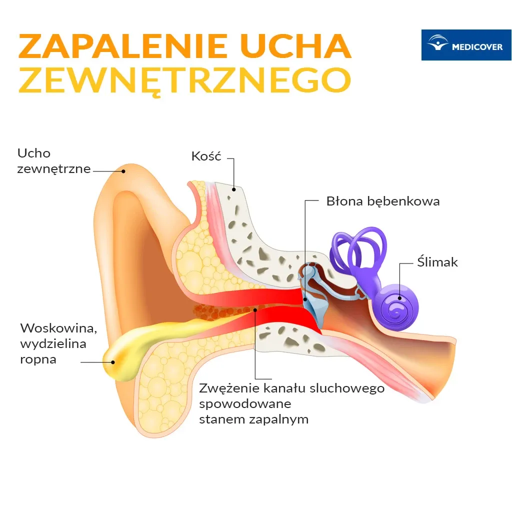 Zdjęcie Jakie leki na zapalenie ucha u dziecka: bezpieczne opcje i porady