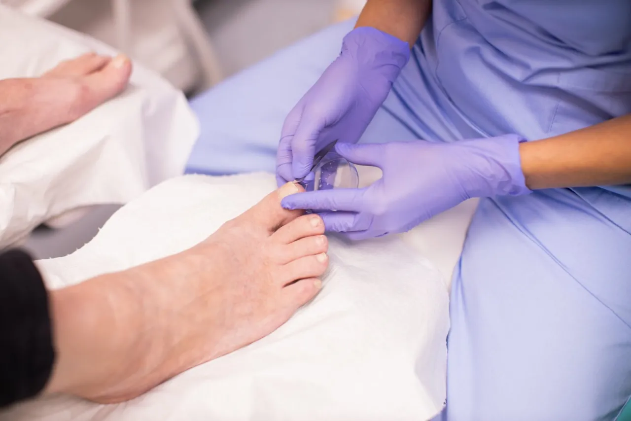 Zdjęcie Jak się przygotować do badania mykologicznego paznokci, by uniknąć błędów