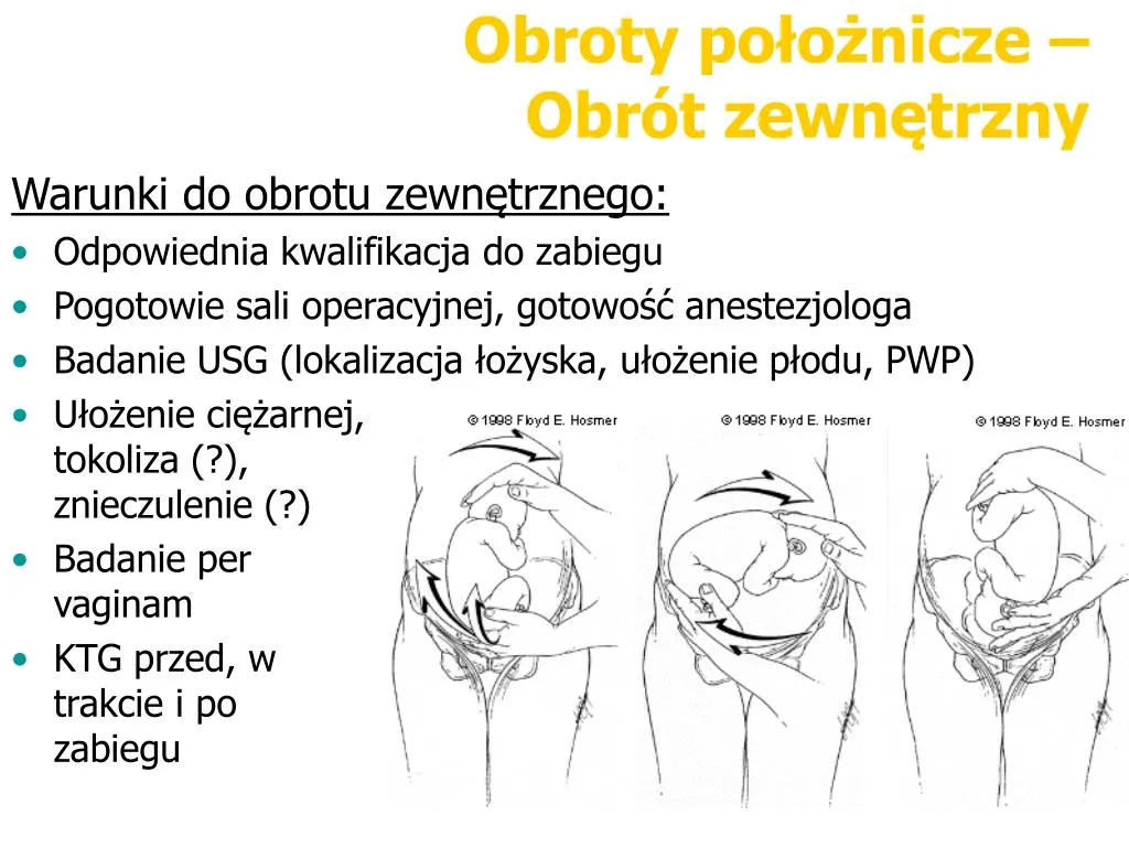 Zdjęcie Położenie miednicowe a objawy porodu - co musisz wiedzieć?