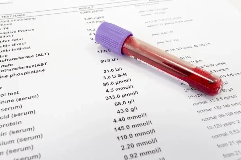 Zdjęcie Kwas moczowy badanie z krwi czy z moczu – co warto wiedzieć o diagnostyce?