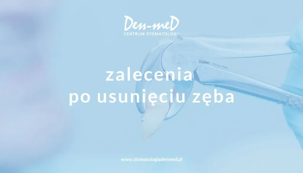 zalecenia po wyrwaniu zęba okład lód