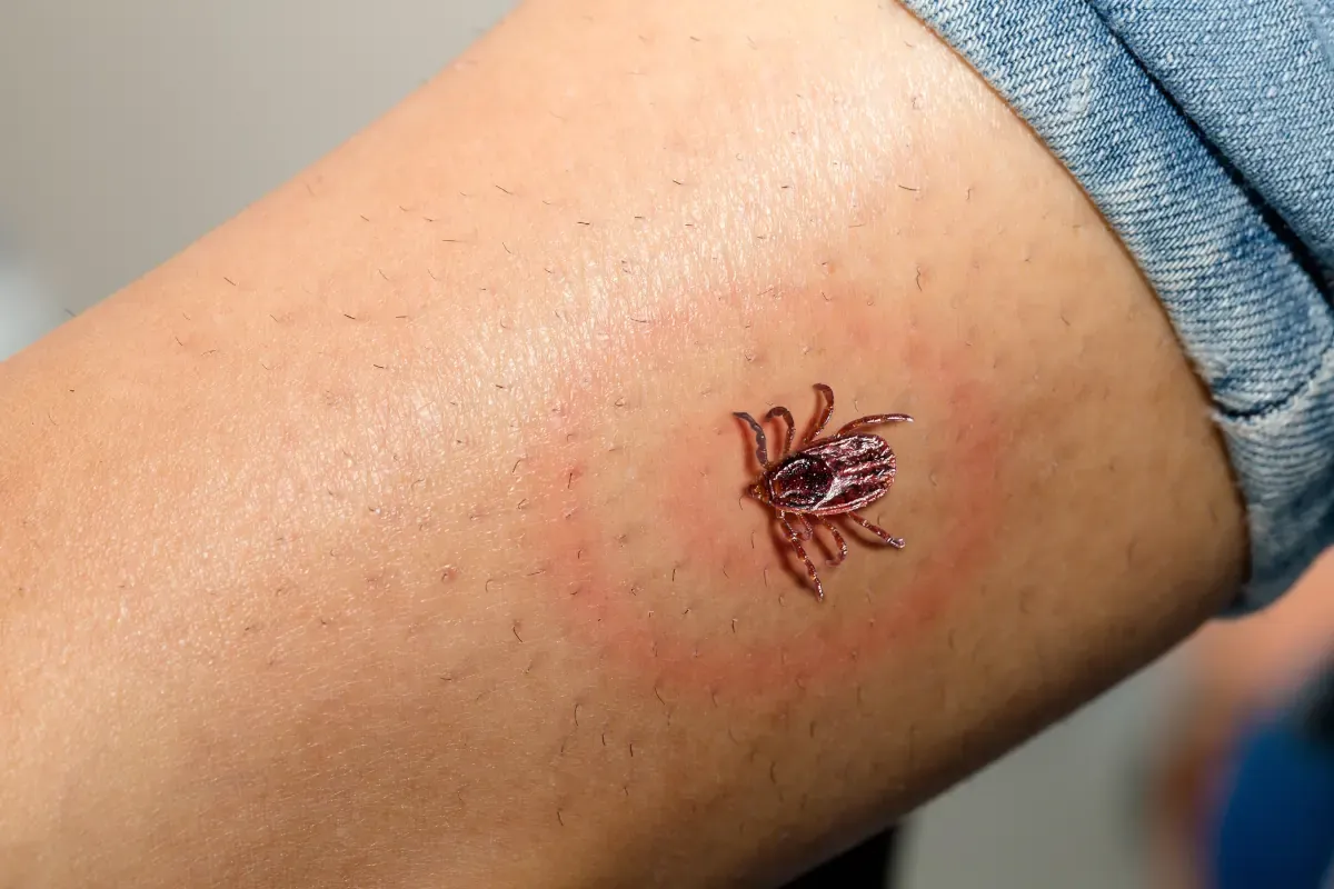 Rumień wędrujący tarcza strzelnicza