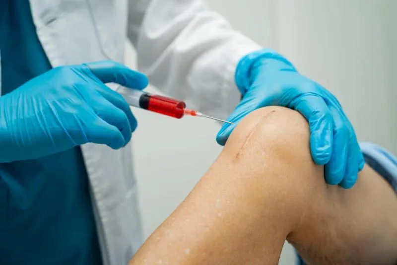 zdrowe stawy kwas hialuronowy ruch