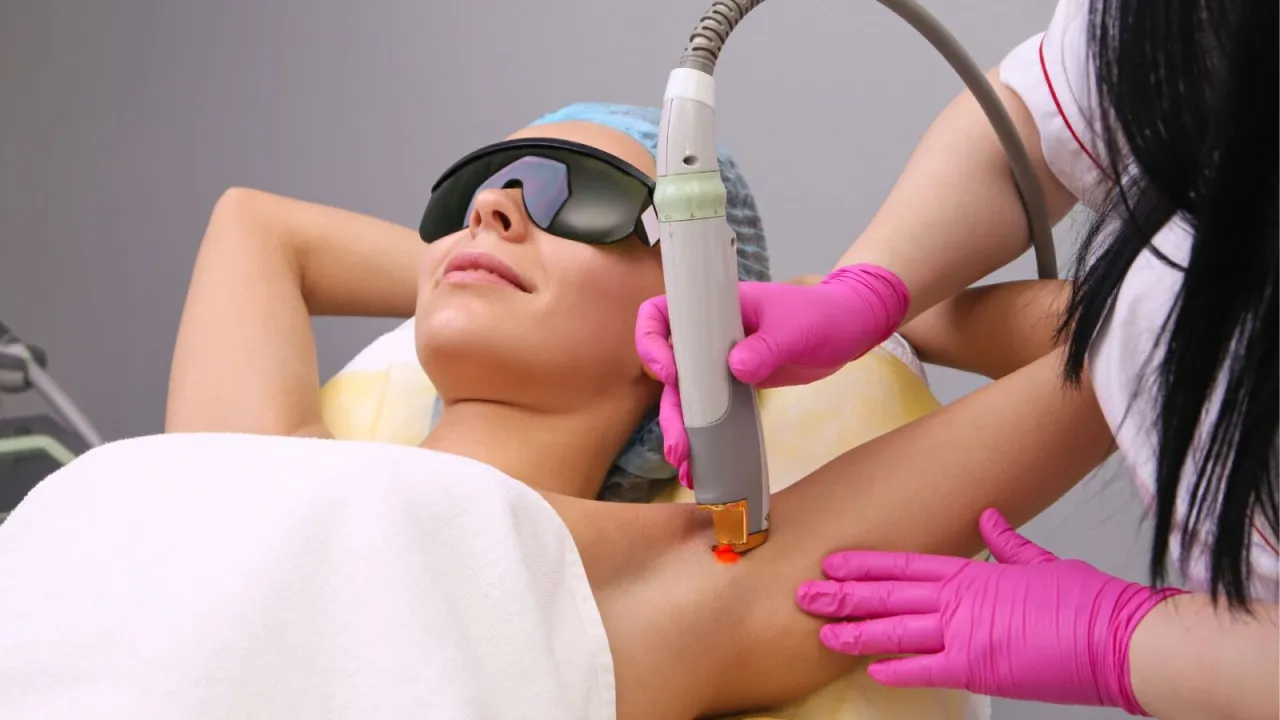 depilacja laserem nd yag ciemna sk&oacute;ra