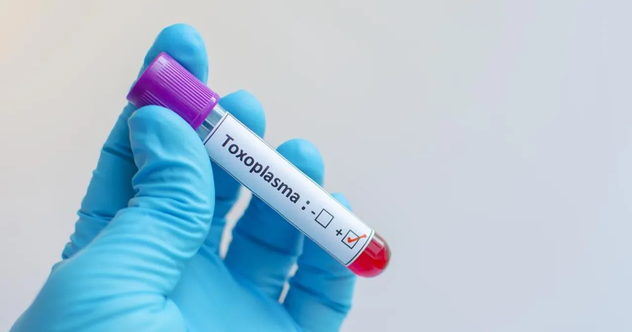 Diagnostyka toksoplazmozy badania krwi