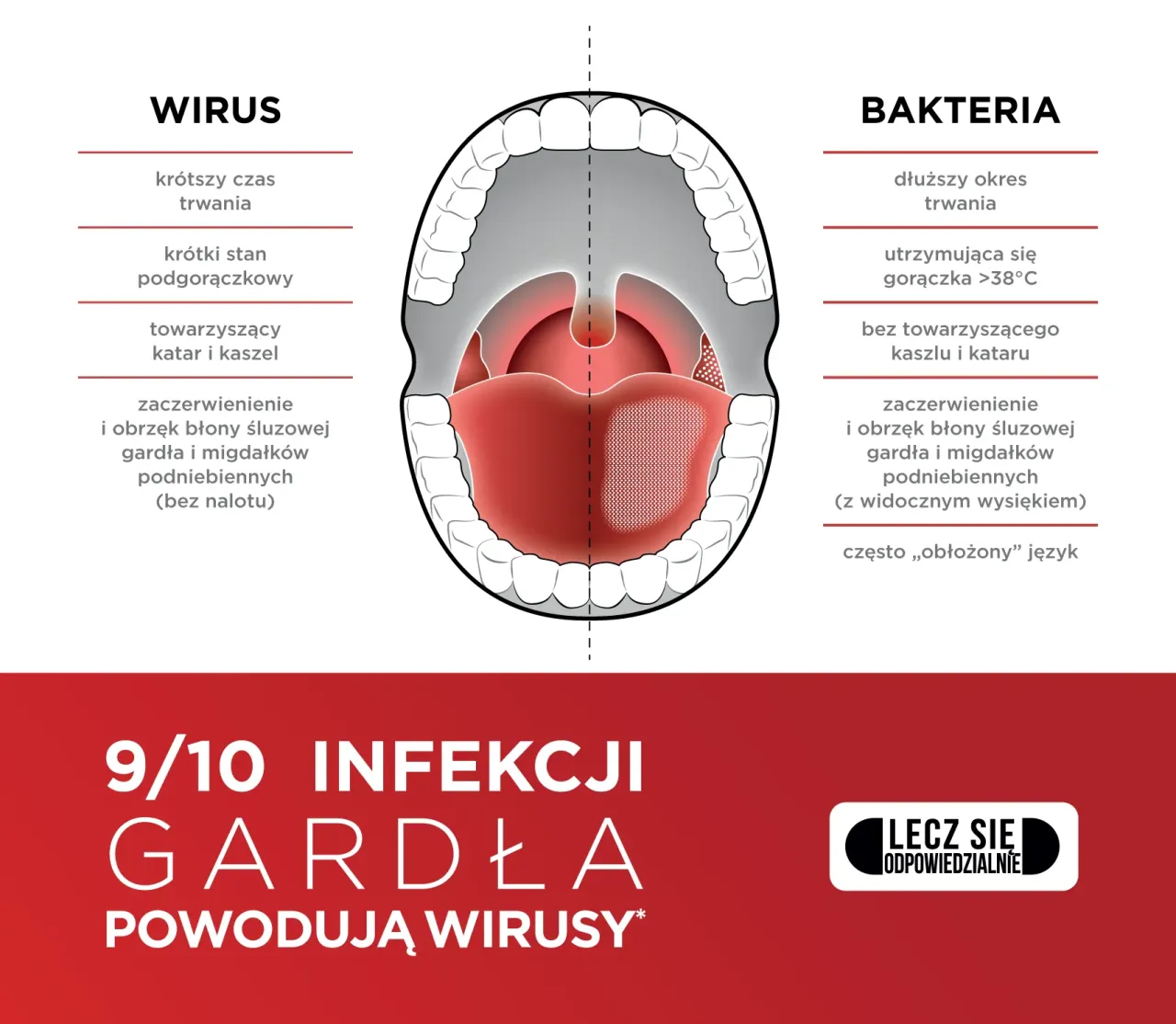 przyczyny bólu gardła wirusy bakterie alergie