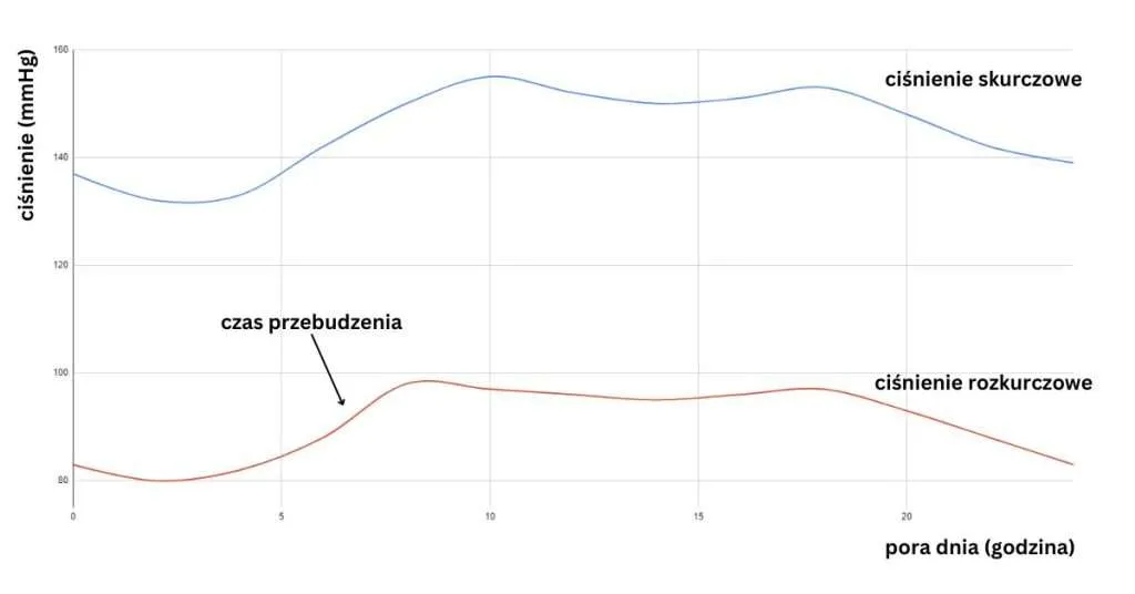 Wykres skoku ciśnienia krwi po odstawieniu leków