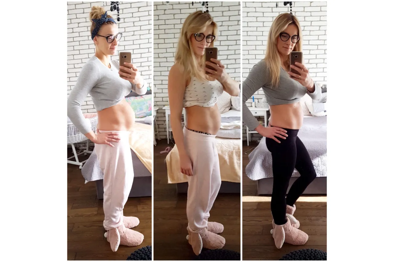 Trzy zdjęcia kobiety pokazujące jej brzuch po ciąży. Widać postępy w walce o płaski brzuch.