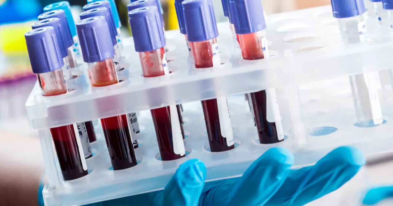 Tabela norm OB wiek płeć