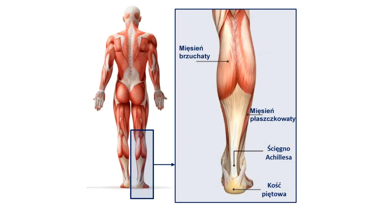 anatomia mięśni łydki przyczyny b&oacute;lu infografika