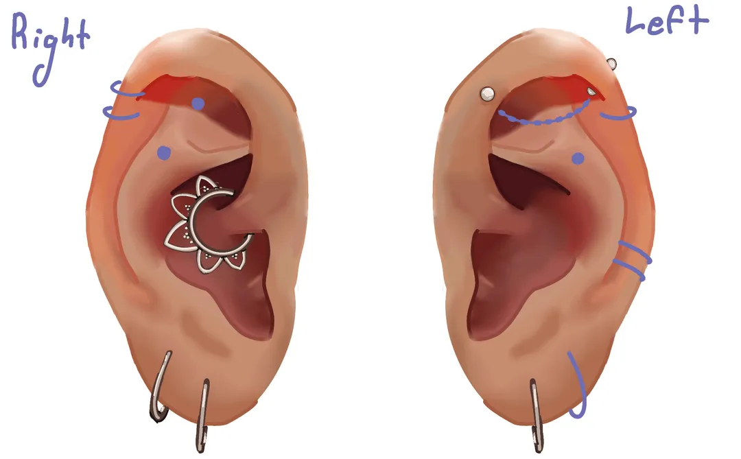 Mapa bólu przekłuć ucha