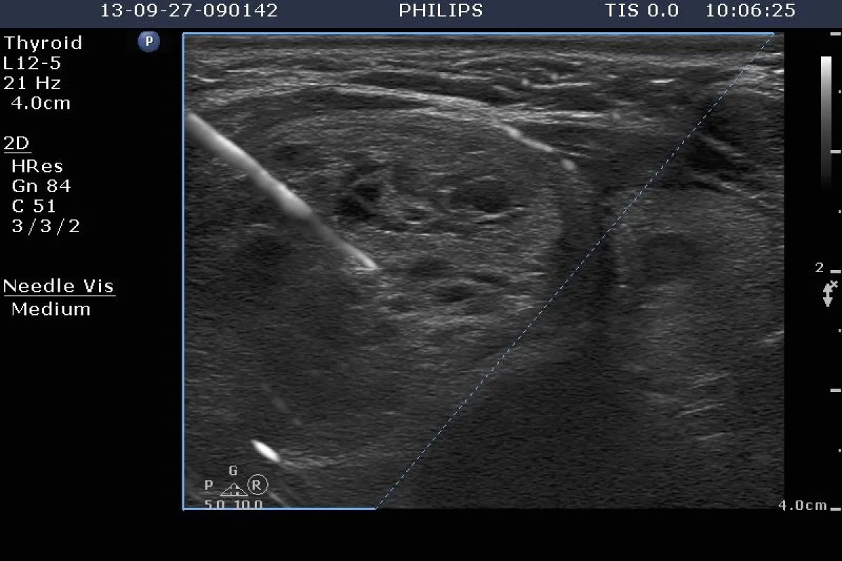 Wyniki badań laboratoryjnych tarczyca