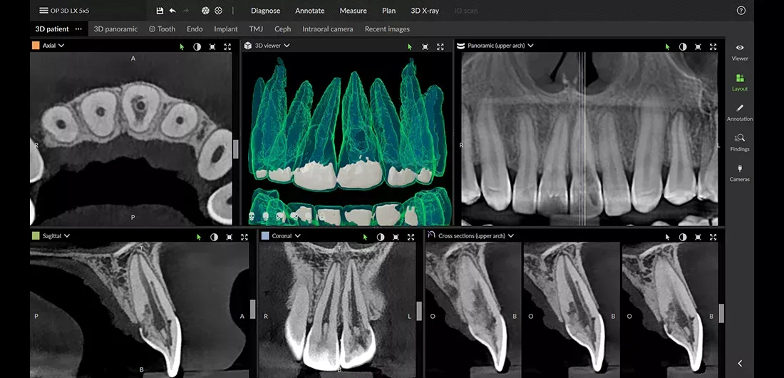 diagnostyka endodontyczna RTG CBCT mikroskop stomatologiczny