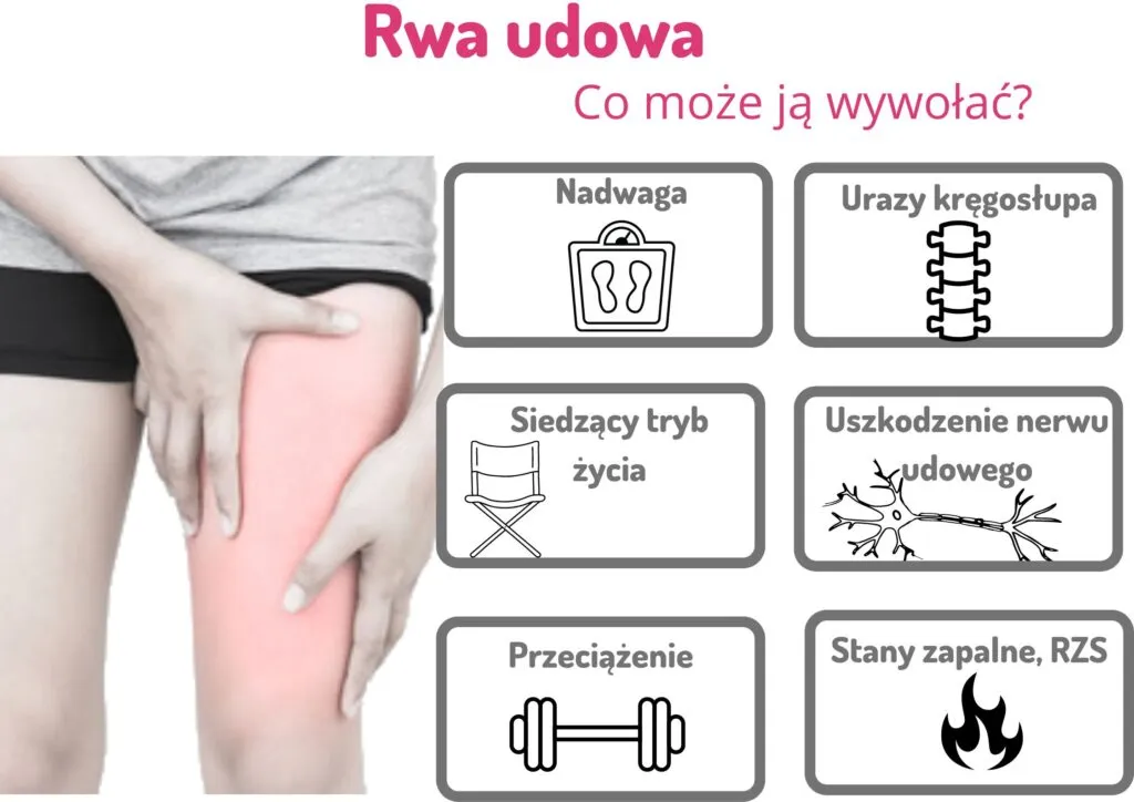 wizyta u lekarza rwa udowa recepta