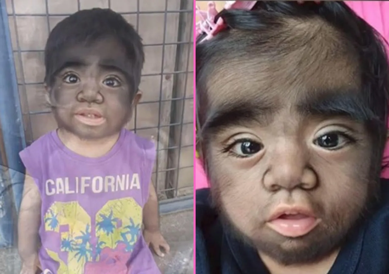 R&oacute;żnica syndrom a choroba