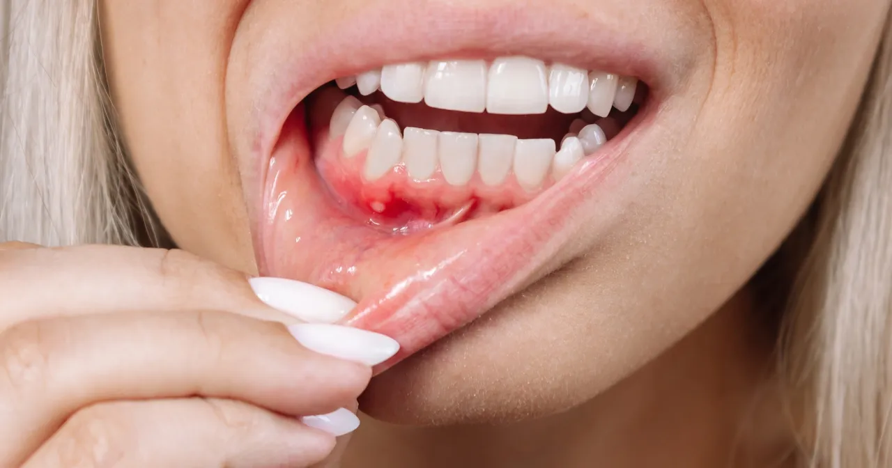 kiedy iść do dentysty ból dziąsła