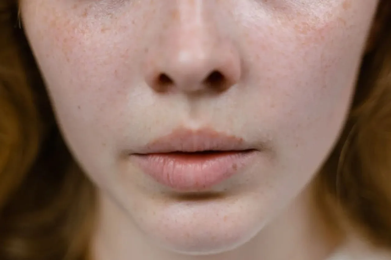 Sk&oacute;ra z zatkanymi porami i zask&oacute;rnikami