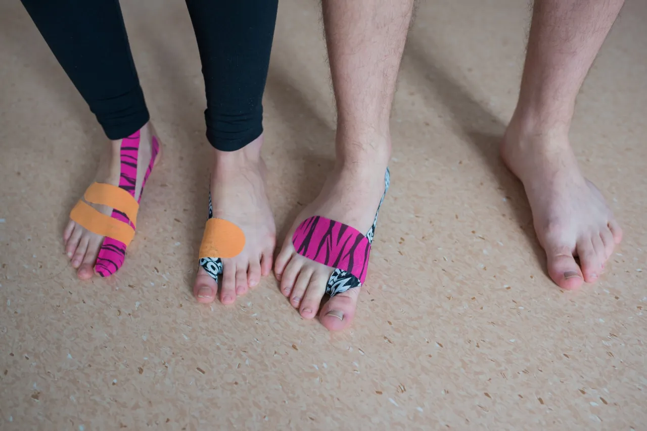 Kinesiotaping na haluksy jak się pozbyć. Dwa stopy z kolorowymi plastrami na paluchach.