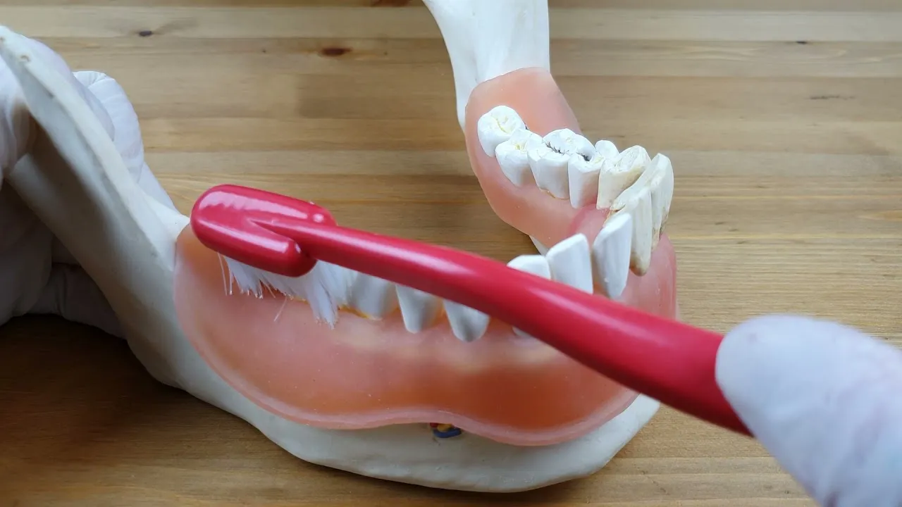 prawidłowa technika szczotkowania zęb&oacute;w metoda wymiatająca