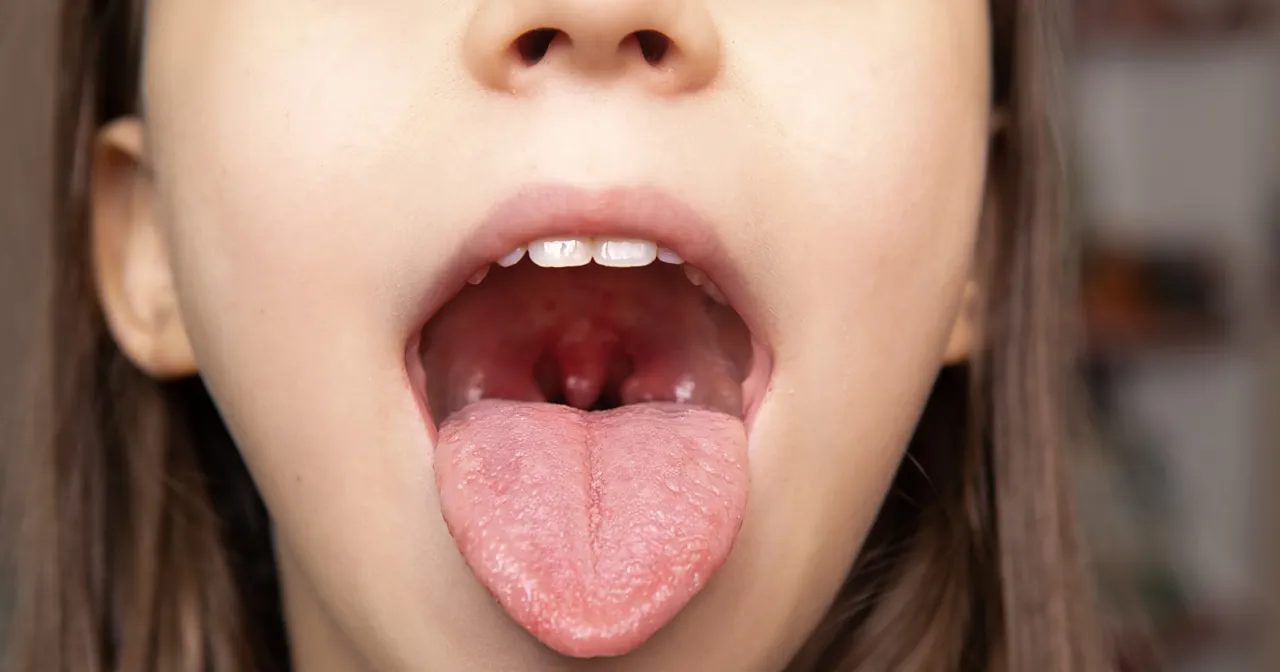 kiedy z bólem gardła u dziecka do lekarza