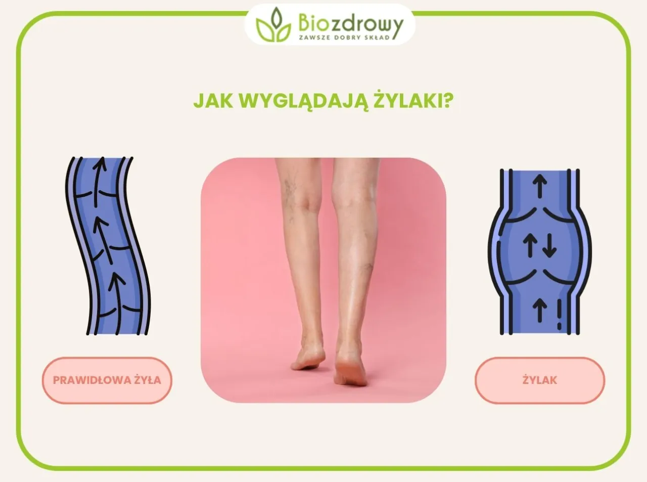 Dieta na zdrowe żyły