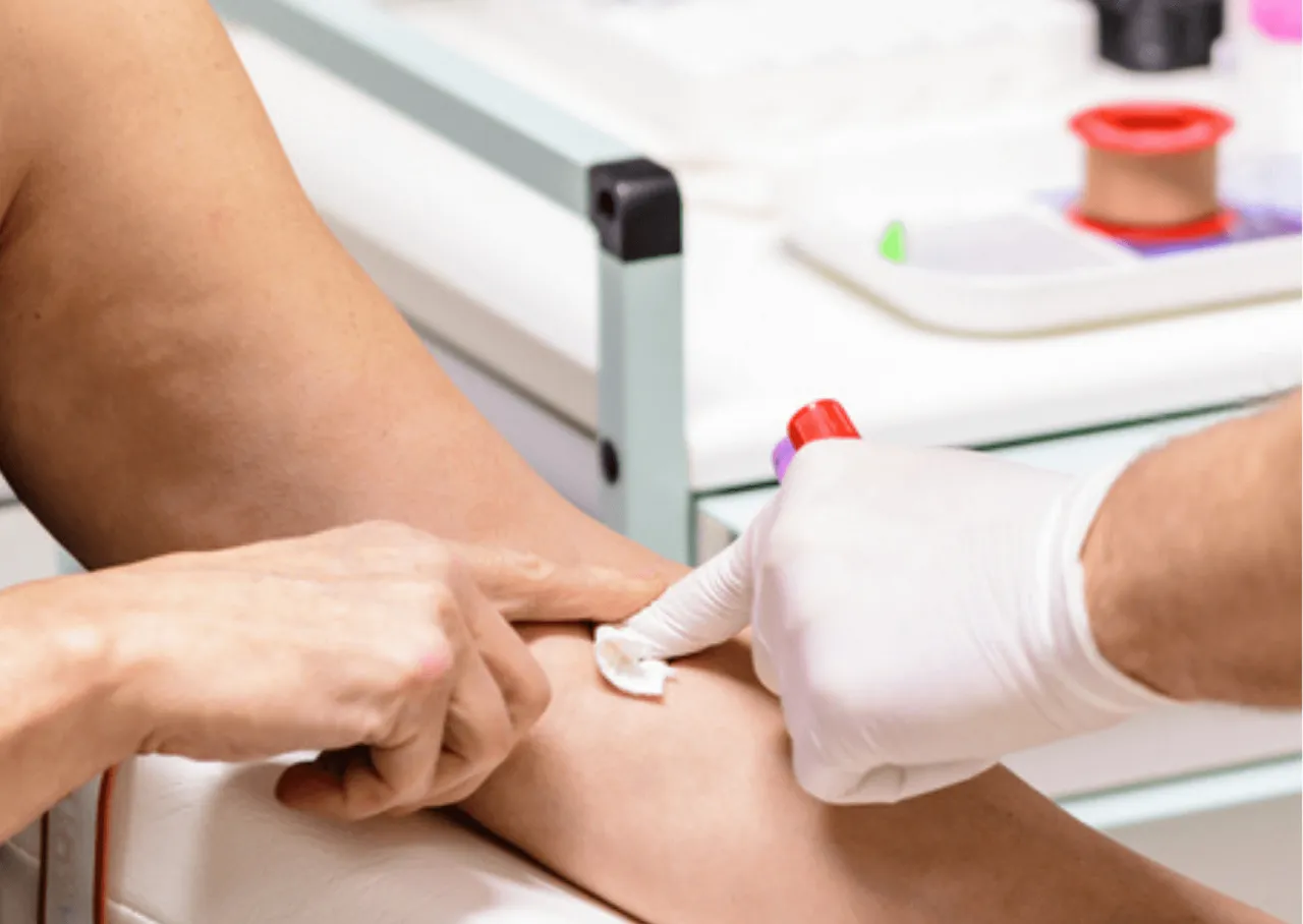 Znaczenie postu przed badaniem krwi